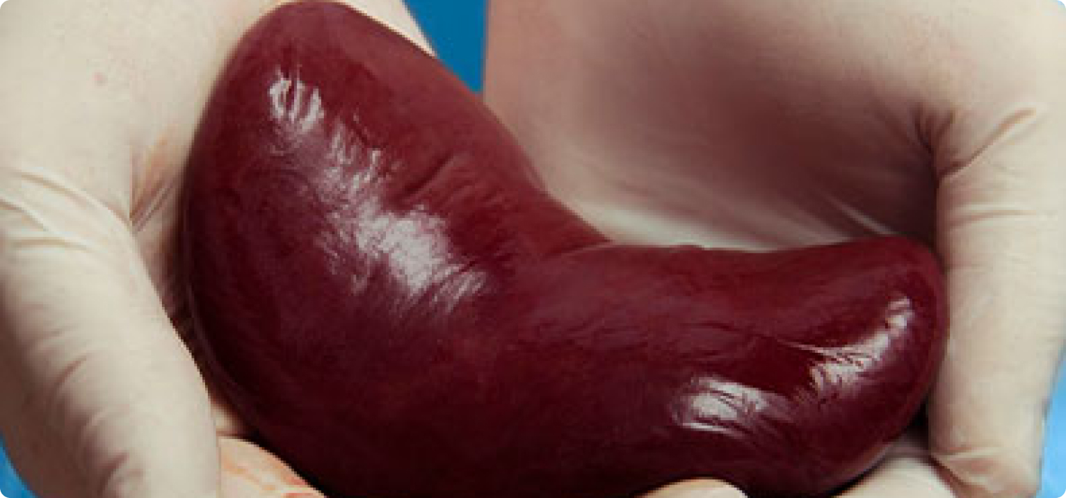 Processo do transplante renal